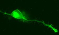 membrane